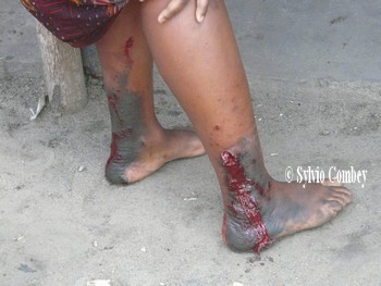 Une femme blessée au pieds jusque dans sa maison (Archives 2012)