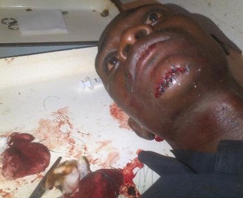 Le reporter Photo-video Fredo Attipou sur son lit d'hôpital